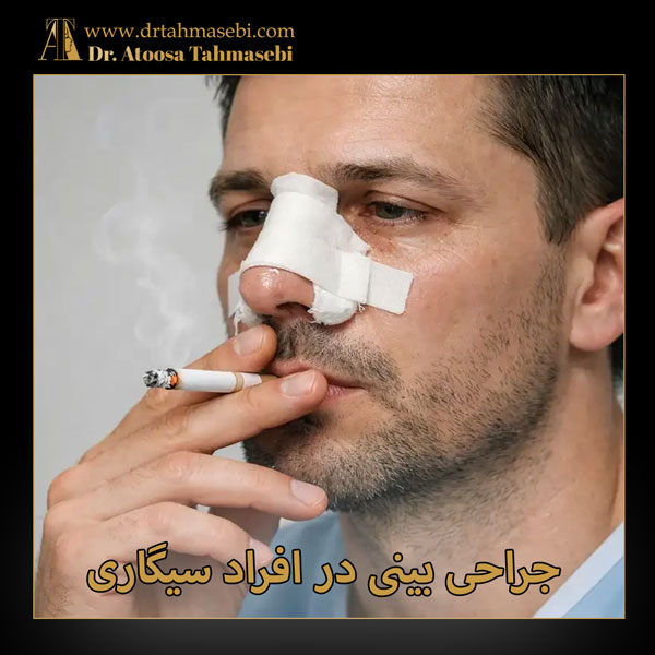 جراحی بینی در افراد سیگاری + دکتر آتوسا طهماسبی
