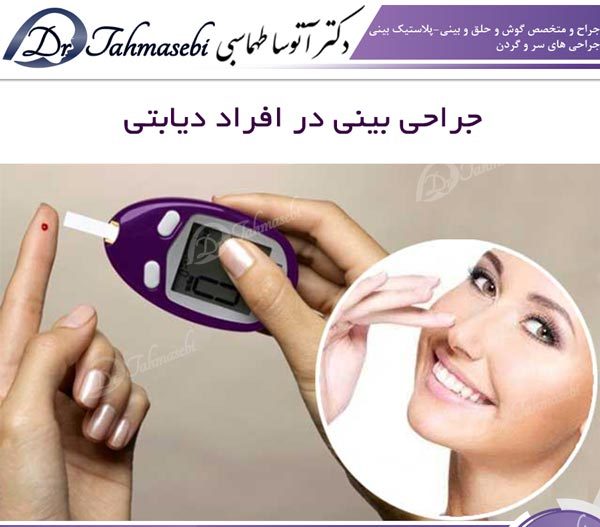 جراحی بینی در افراد دیابتی