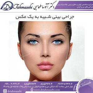 جراحی بینی شبیه به یک عکس
