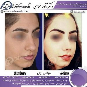جراح بینی در تهران