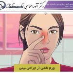 چگونه ورم جراحی بینی را درمان کنیم ؟