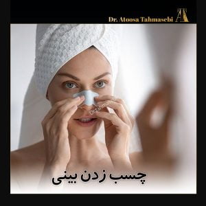 چسب زدن بینی - دکتر آتوسا طهماسبی در خرم آباد