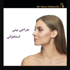 جراحی بینی استخوانی - دکتر آتوسا طهماسبی در خرم آباد