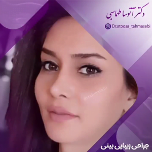 جراحی بینی استخوانی در خرم اباد - دکتر آتوسا طهماسبی