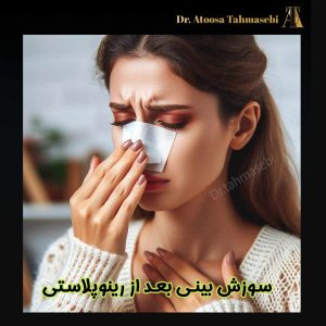 سوزش بینی بعد از رینوپلاستی - دکتر آتوسا طهماسبی