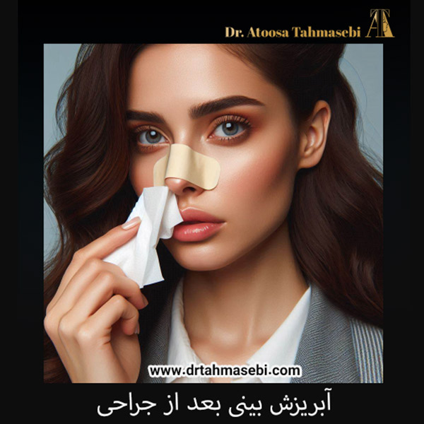 آبریزش بینی بعد از جراحی - دکتر آتوسا طهماسبی