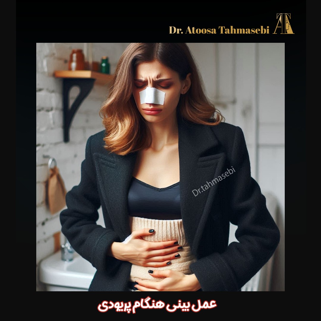 عمل بینی هنگام پریودی -