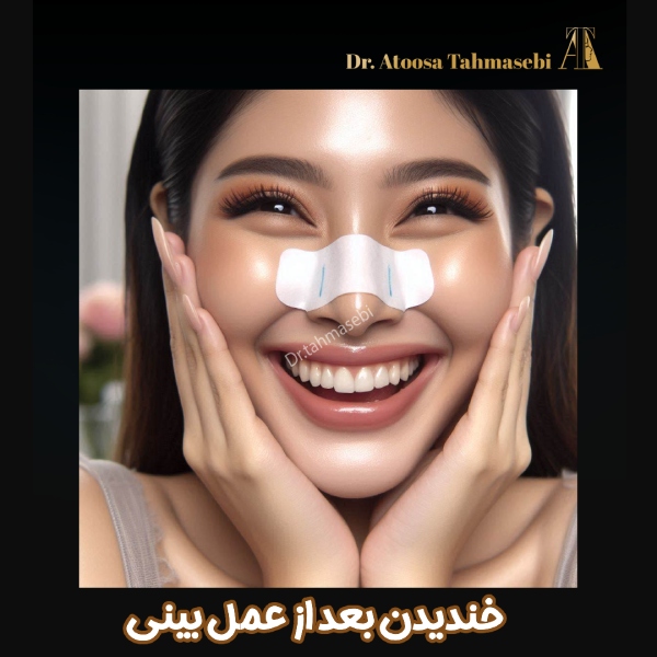 خندیدن بعد از عمل بینی - دکتر آتوسا طهماسبی https://drtahmasebi.com/