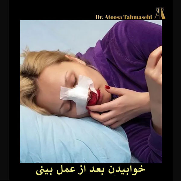 خوابیدن بعد از عمل بینی _ دکتر آتوسا طهماسبی