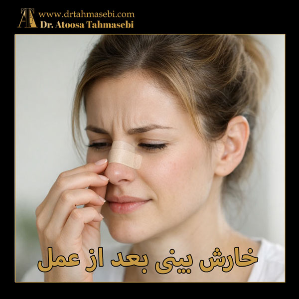 خارش بینی بعد از عمل + دکتر اتوسا طهماسبی
