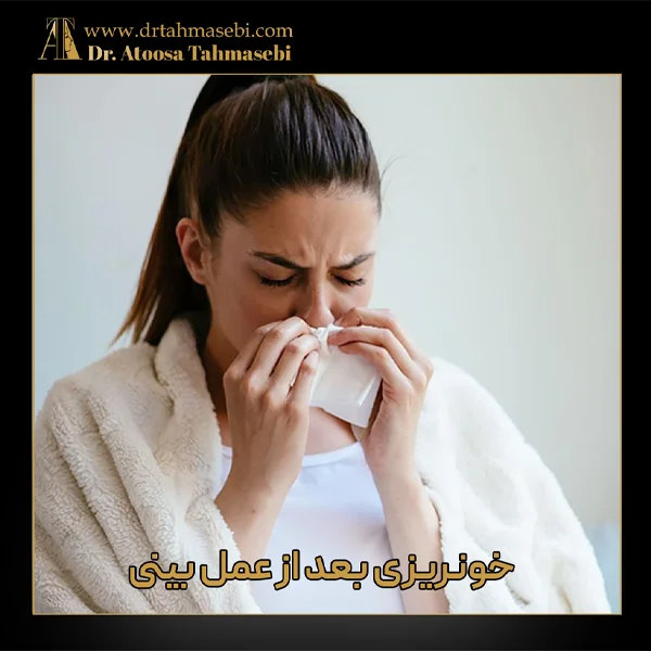 خونریزی بعد از عمل بینی - دکتر طهماسبی