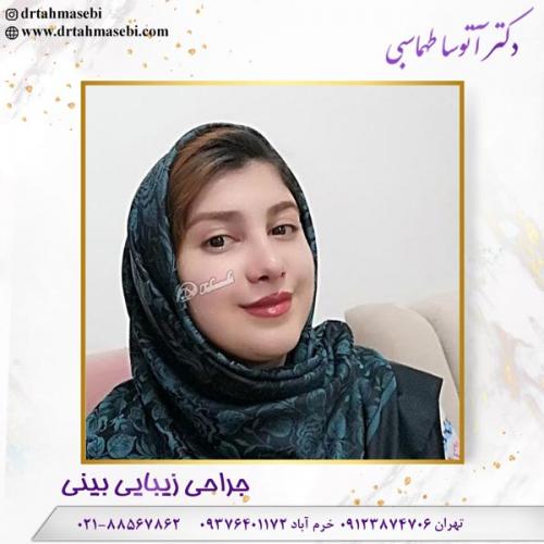 جراحی بینی 106